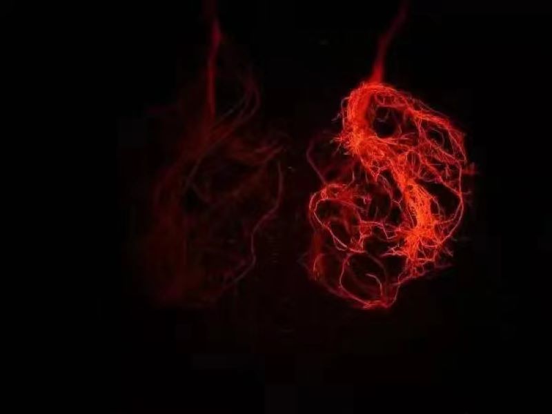 RFP在大豆根係的表達